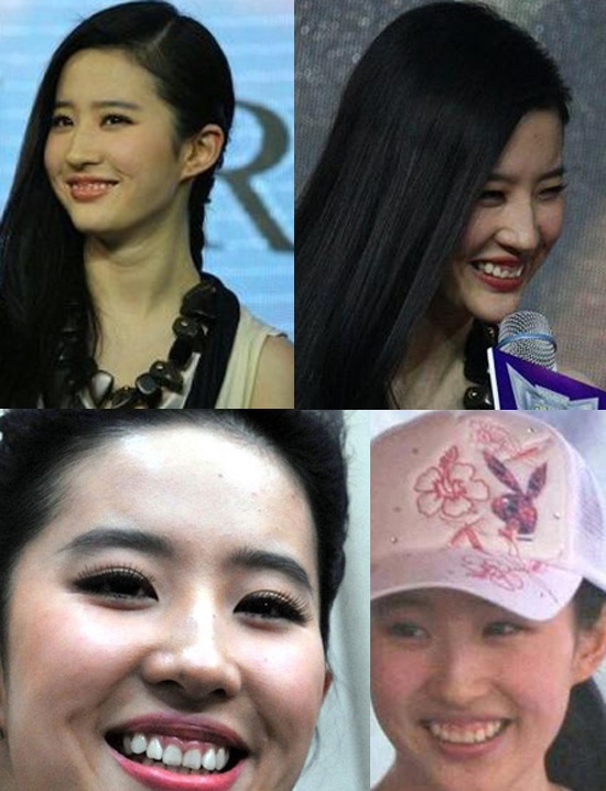 Lưu Diệc Phi từng tự nhận mình là sao đẹp nhất Cbiz nhưng nụ cười hở lợi và hàm răng xấu vô tình