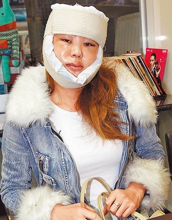 Phẫu thuật thẩm mỹ là chuyện không hiếm ở showbiz khi các sao muốn tìm đến hình ảnh ngoại hình bắt mắt hơn. Nhưng 50 tuổi vẫn làm thẩm mỹ thì không phải ai cũng dám. Nữ ca sĩ sinh năm 1965 của Đài Loan - Lam Tâm Mi trong show truyền hình mới đây đã tiết lộ, đúng dịp Tết vừa rồi, cô đã chỉnh cằm để có vùng cằm như ý.