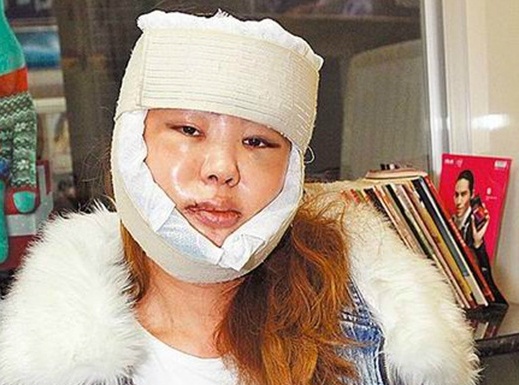 Ca si Dai Loan dai phau tham my suot 13 nam hinh anh