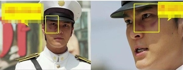 Vết bầm của nam chính Kang To (Joo Won) trong bộ phim Bridal Mask đang nằm ở dưới  mắt bên phải nhưng sau đó lại chuyển thành ở dưới mắt bên trái.