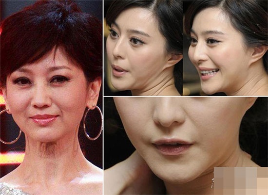 Triệu Nhã Chi (ảnh trái) từng được khen là 