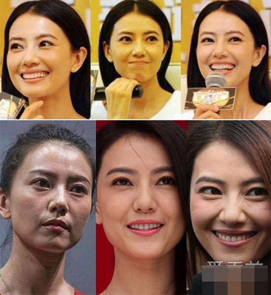 Nhan sắc bình thường với làn da sần sùi của Cao Viên Viên.