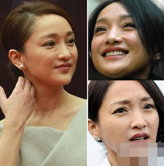 Châu Tấn sở hữu làn da xấu không tả nổi.