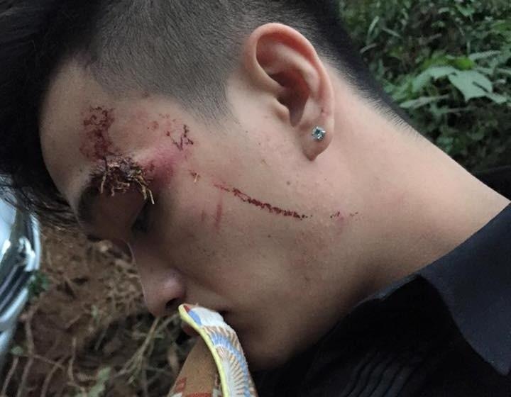 Nhom HKT huy show sau tai nan giao thong o Son La hinh anh