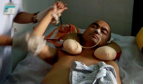 Nguyen Hoang cho ngay xuat vien sau 1 thang ruoi mo nao hinh anh