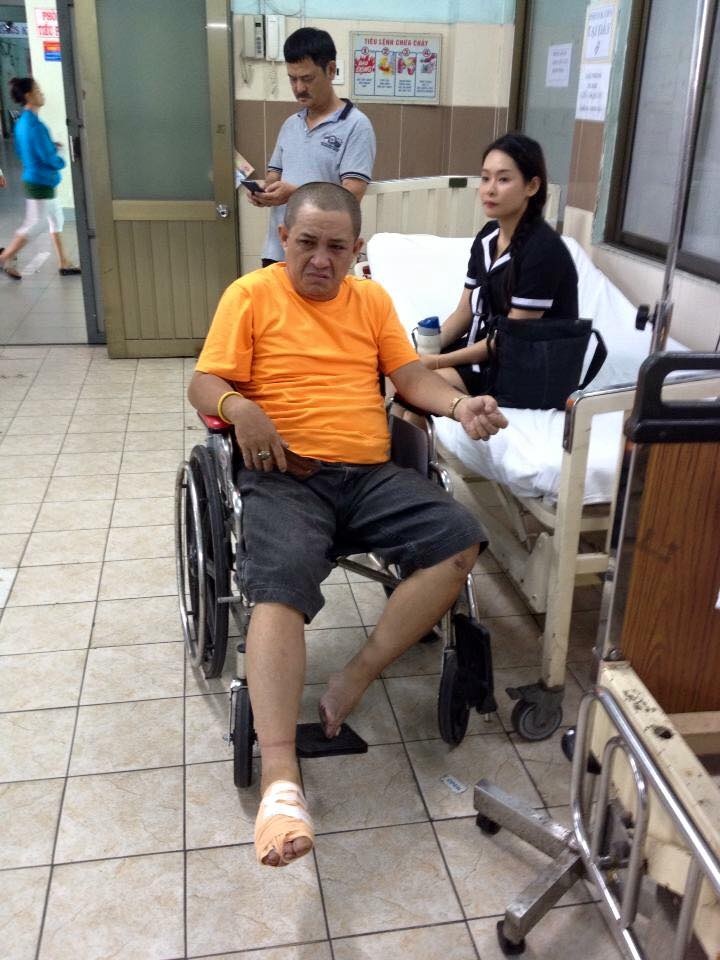 Thanh Long Trẻ bị tai nạn đứt chân ảnh 1 Thanh Long Tre bi tai nan dut chan anh 1