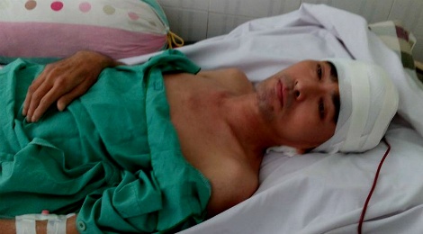 Dien vien Nguyen Hoang phau thuat ghep hop so thanh cong hinh anh