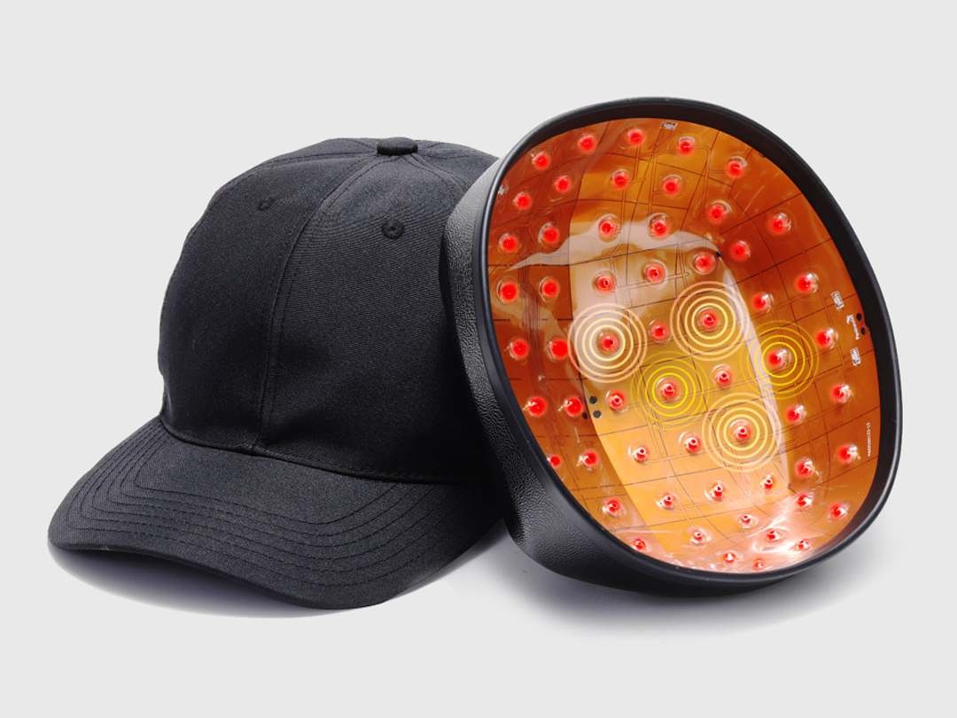 Xiaomi goi von mu kich thich moc toc hinh anh