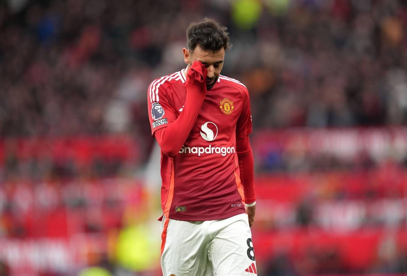 Con so kho tin trong tham bai cua MU hinh anh