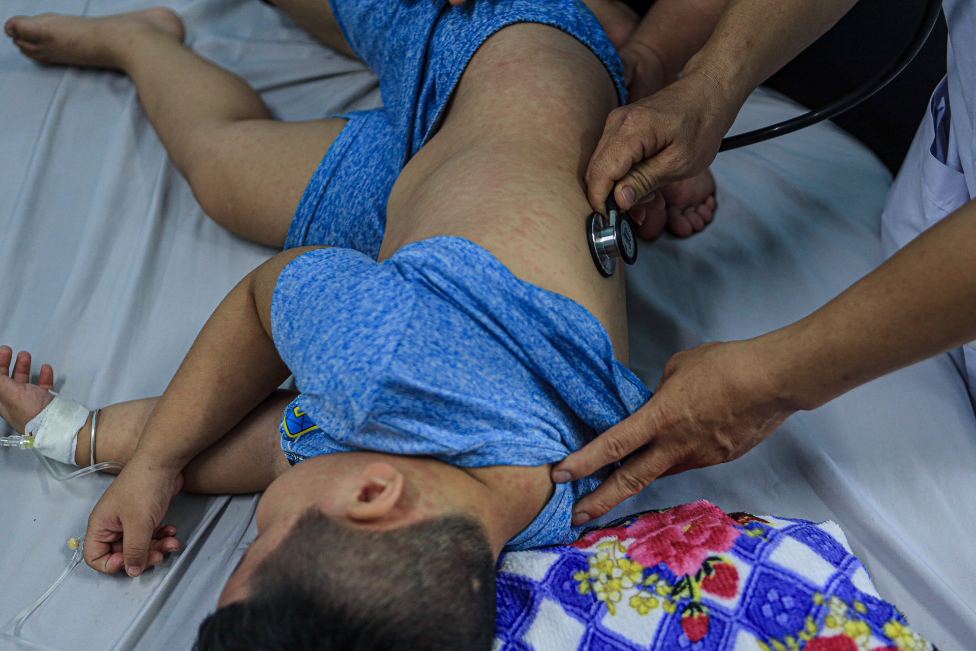 Ai duoc tiem bo sung vaccine soi o TP.HCM? hinh anh