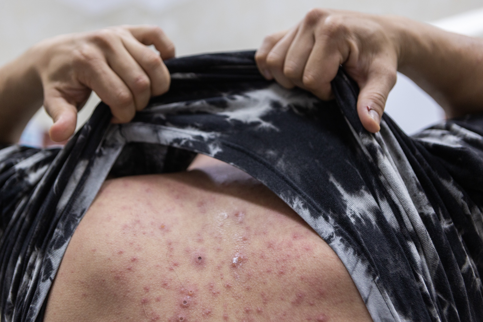 benh vien da lieu anh 9