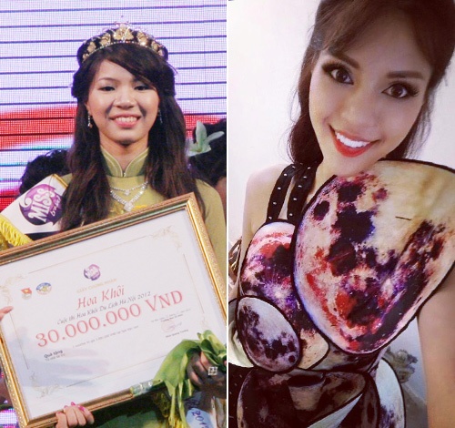 Khả Trang thừa nhận phẫu thuật thẩm mỹ ảnh 3 Kha Trang thua nhan phau thuat tham my anh 3