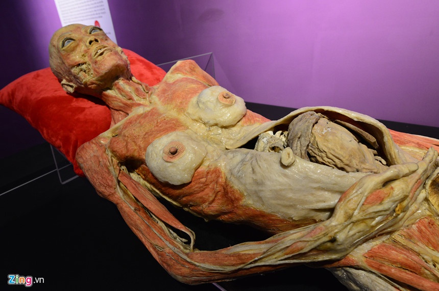 trien lam co the nguoi anh 2