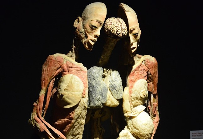 Cuc My thuat: 'Trung bay dai chung co the nguoi that la phan cam' hinh anh