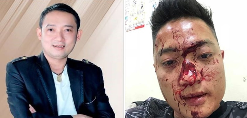 Dien vien hai Chien Thang thue ve si danh dap khan gia? hinh anh