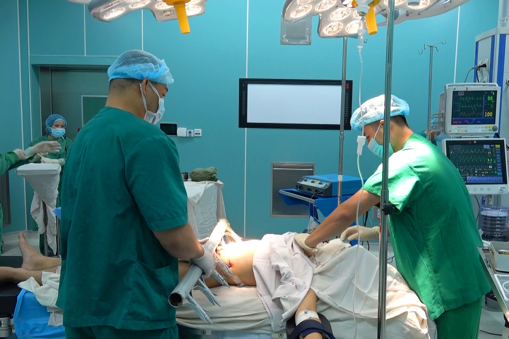 Cuu nam benh nhan bi hang rao dam xuyen bung hinh anh