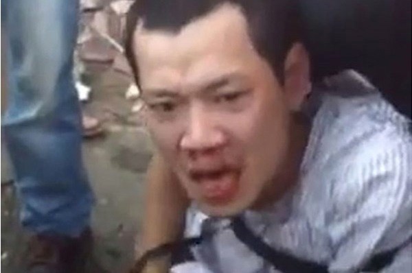 Phan ung trai chieu ve viec danh hoi dong ke cuop tren pho hinh anh