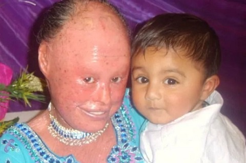 Can benh quai go khien co gai co nuoc da nhu loai ran hinh anh