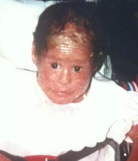 Những căn bệnh kì lạ ảnh 2 Nhung can benh ki la anh 2