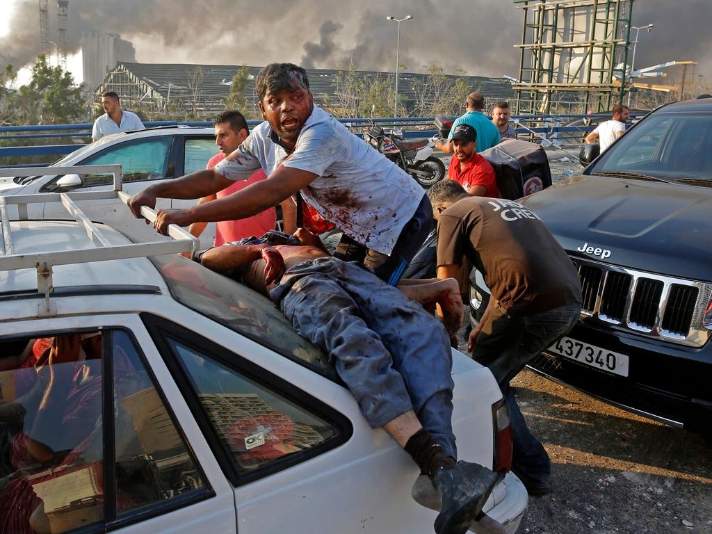 So nguoi chet o Beirut tang len 135, hon 5.000 nguoi bi thuong hinh anh