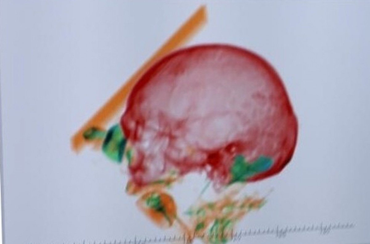 Vo mang xuong cua chong da mat di may bay qua 4 nuoc hinh anh