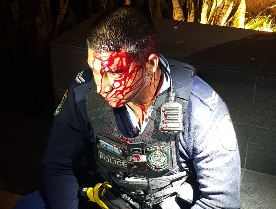 Canh sat Australia bi chem vao dau khi tran ap nghi pham hinh anh