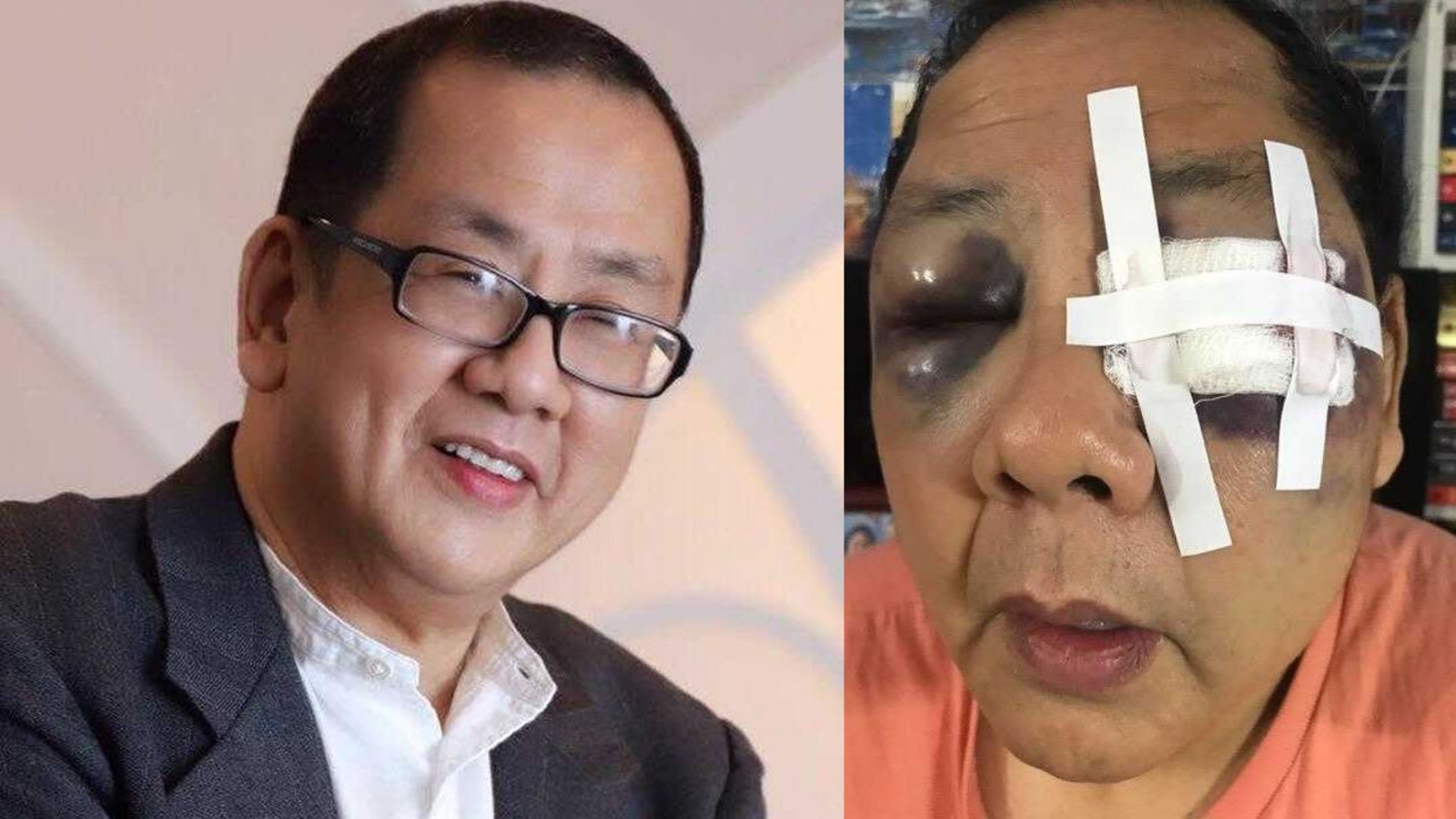 nguoi goc A bi hanh hung anh 1