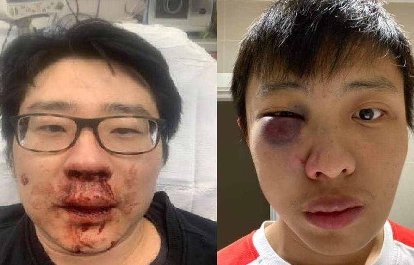 Nguoi goc A dang la nan nhan cua thu ghet tren khap the gioi hinh anh