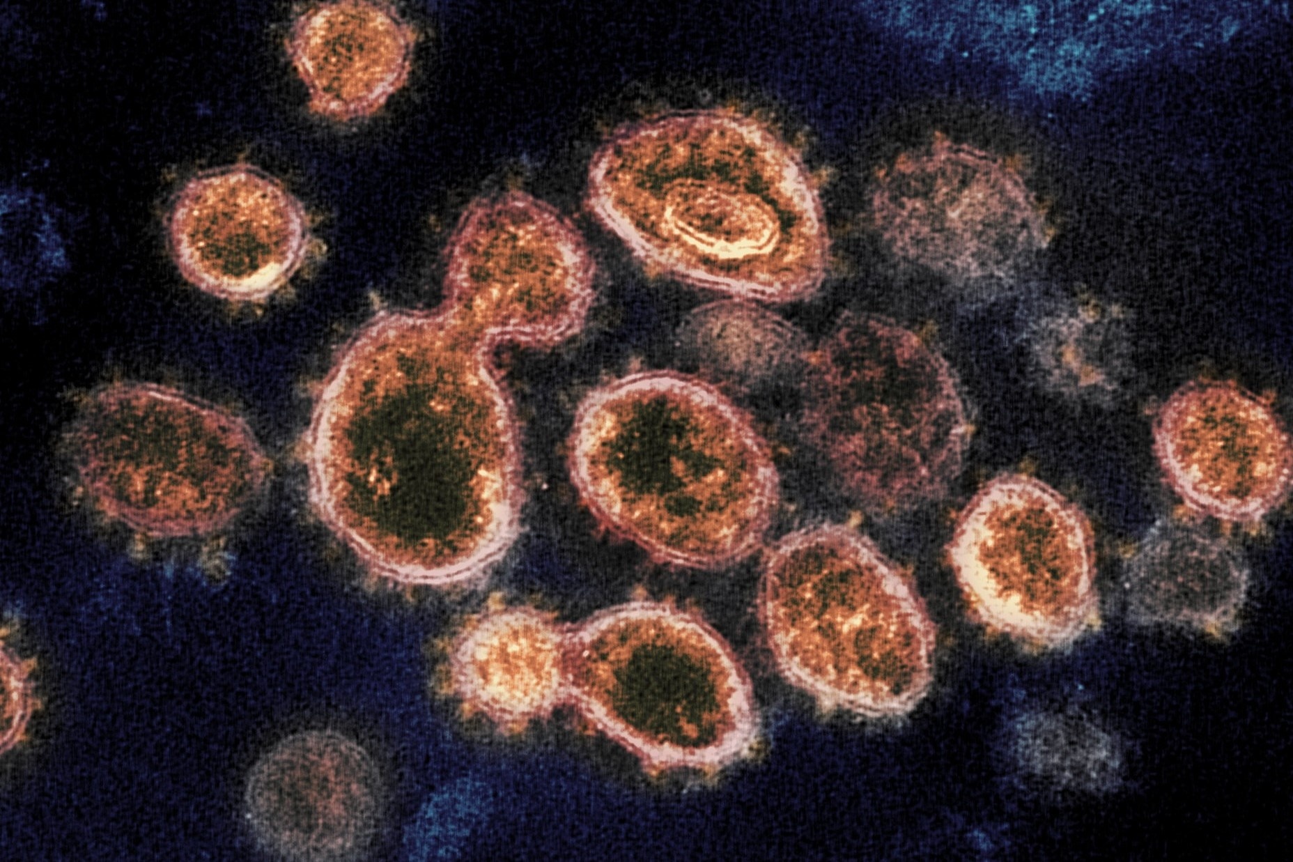 An Do phat hien bien chung virus corona 'dot bien kep' hinh anh