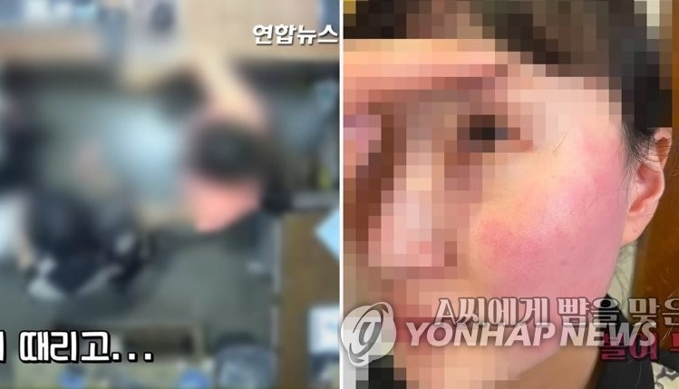 vo dai su bi tat nhan vien quet rac anh 1