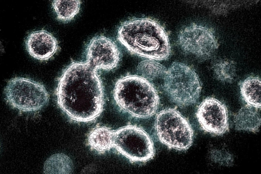 Virus SARS-CoV-2 co the tru an trong noi tang hang tram ngay hinh anh