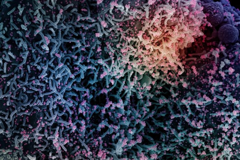 Phat hien moi ve nguyen nhan hien tuong Covid-19 keo dai hinh anh