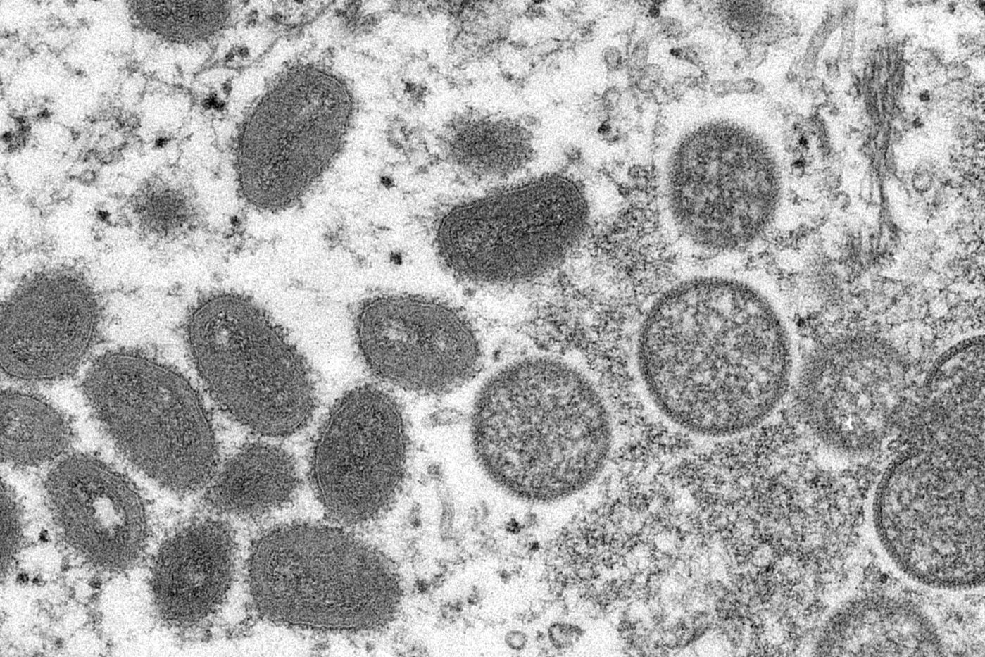 Vaccine dau mua khi bat ngo duoc san tim hinh anh