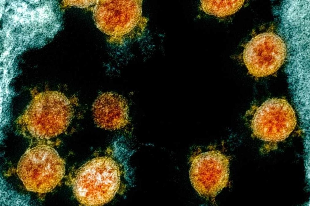 Trung Quoc cong bo du lieu Covid-19 truoc phien hop voi WHO hinh anh