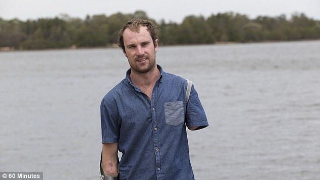 Suyt bo mang vi bi 2 con ca map trang tan cong hinh anh