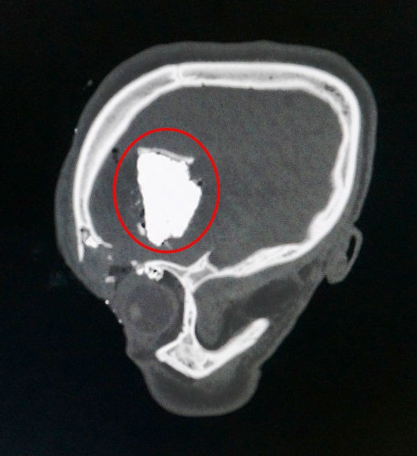 Vo so vi manh luoi cua vang vao dau hinh anh