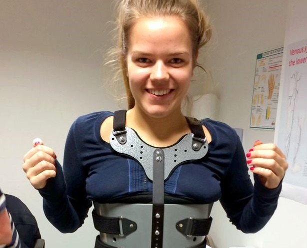 Co gai thoat nguy co bi liet nho mac hoi chung xuong mem hinh anh