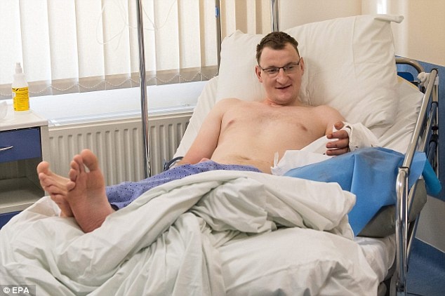 Nguoi khuyet tat dau tien tren the gioi duoc ghep tay thanh cong anh 1