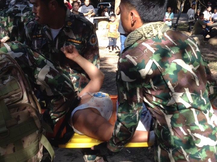 Du khach Phap bi ca sau can khi co gang den gan chup anh anh 1