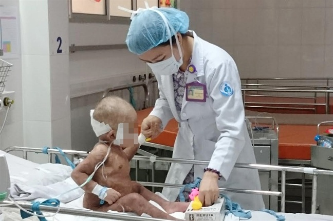 Bé trai 25 tháng tuổi bị nhiễm độc da ảnh 2 Be trai 25 thang tuoi bi nhiem doc da anh 2