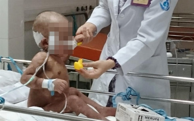 Bé trai 25 tháng tuổi bị nhiễm độc da ảnh 1 Be trai 25 thang tuoi bi nhiem doc da anh 1