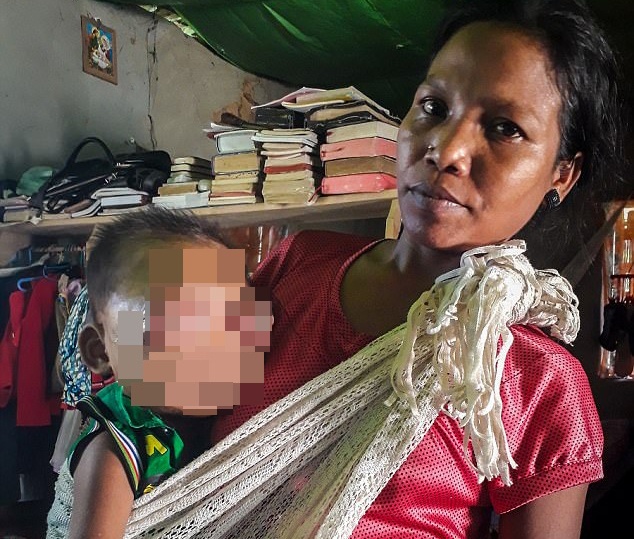 Mac can benh hiem, be trai khong the nham mat hinh anh