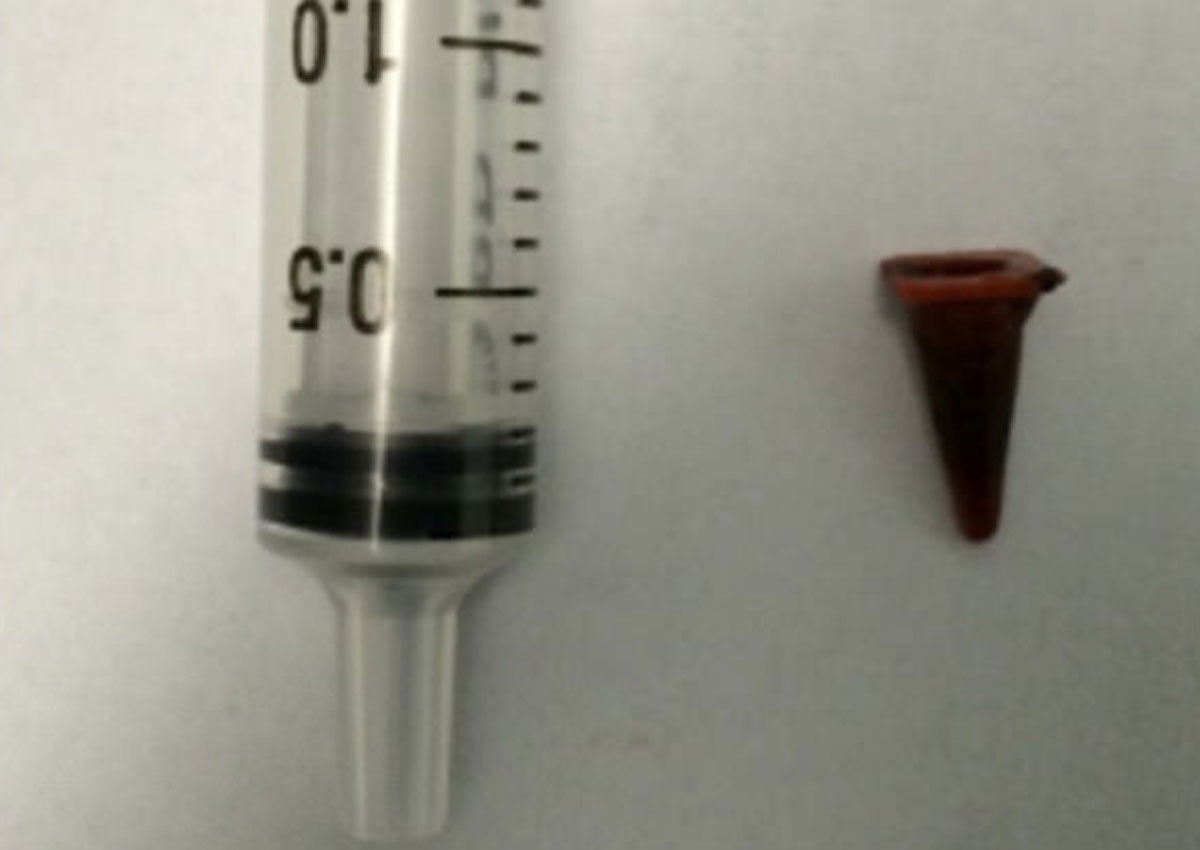 vat la trong phoi anh 1