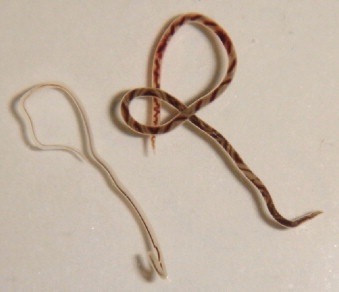 Nhap vien vi nhiem giun tron ky sinh tren chuot hinh anh