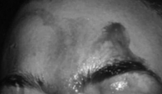 mồ hôi máu ảnh 1 mo hoi mau anh 1