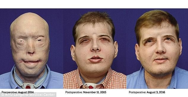 ca ghép mặt lớn nhất thế giới ảnh 1 ca ghep mat lon nhat the gioi anh 1