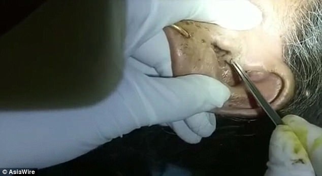 Bac si gap 30 con gioi ra khoi tai cu ba hinh anh