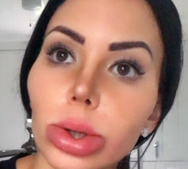 nghien phau thuat tham my anh 3