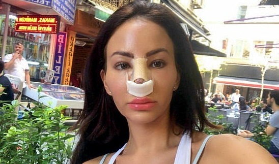 nghien phau thuat tham my anh 4