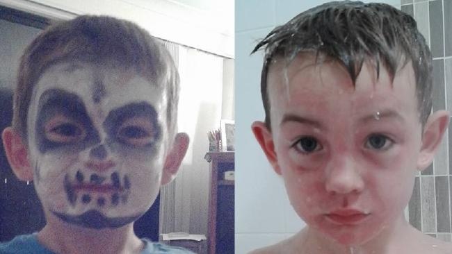 Cau be bi bong da mat sau khi trang diem choi Halloween hinh anh